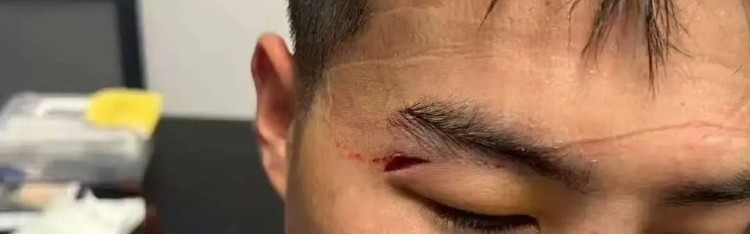 津媒：王献钧两颗门牙被撞断，杨帆眉骨受伤赛后去医院缝针